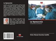 La Liposuccion (en Francés)