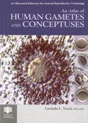 An Atlas of Human Gametes and Conceptuses: An Illustrated Reference for Assisted Reproductive Technology (en Inglés)