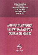 Artoplastia Invertida en Fracturas Agudas y Cronicas del Hombro