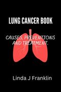 Lung Cancer Book: Causes, preventions and treatment