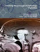 Cracking Neurosurgical Pathology Vignettes 