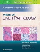 Atlas of Liver Pathology: A Pattern-Based Approach (en Inglés)