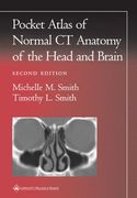 Pocket Atlas of Normal ct Anatomy of the Head and Brain (Radiology Pocket Atlas Series) (en Inglés)