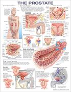 The Prostate Anatomical Chart (en Inglés)