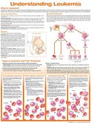 Understanding Leukemia Anatomical Chart (en Inglés)