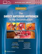 The Direct Anterior Approach to Hip Reconstruction (en Inglés)
