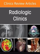 Pulmonary Vascular Disease, an Issue of Radiologic Clinics of North America (Volume 63-2) (The Clinics: Radiology, Volume 63-2) (en Inglés)