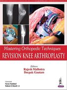 Revision Knee Arthroplasty (Mastering Orthopedic Techniques)