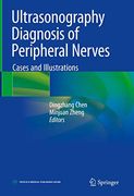 Ultrasonography Diagnosis of Peripheral Nerves: Cases and Illustrations (en Inglés)