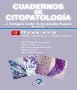 Citologia Cervical: Tiroides Glándula Salival y Ganglio Linfático