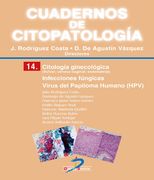 Citologia Cervical: Infecciones Fúngicas, Virus.