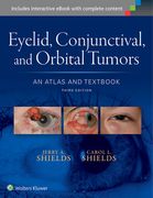 Eyelid, Conjunctival, and Orbital Tumors: An Atlas and Textbook (en Inglés)