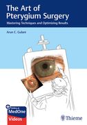 The Art of Pterygium Surgery: Mastering Techniques and Optimizing Results