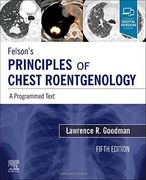 Felson's Principles of Chest Roentgenology, a Programmed Text: A Programmed Text: (en Inglés)