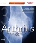 Arthritis in Black & White (en Inglés)