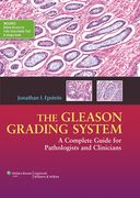 The Gleason Grading System: A Complete Guide for Pathologist and Clinicians (en Inglés)