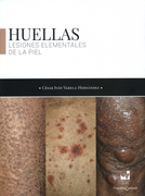 ATLAS DE DERMATOLOGIA CLINICA PIELES OSCURAS