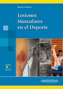 Lesiones Musculares en el Deporte