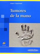 Tumores de la Mano