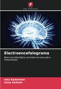 Electroencefalograma: Base Neurofisiológica, Princípios de Execução e Interpretação (en Portugués)