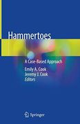 Hammertoes: A Clinical Cas