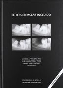 EL TERCER MOLAR INCLUIDO. 2ED