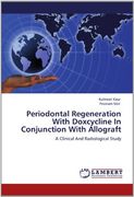 periodontal regeneration with doxcycline in conjunction with allograft (en Inglés)