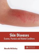 Skin Diseases: Eczema, Psoriasis and Related Conditions