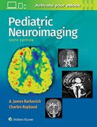 Pediatric Neuroimaging (en Inglés)