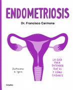 Endometriosis