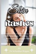 Skin Rashes: Understanding, Treating, And Preventing Skin Conditions (en Inglés)