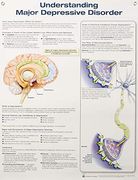 Understanding Depression (en Inglés)