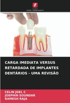 portada Carga Imediata Versus Retardada de Implantes Dentários - uma Revisão (en Portugués)