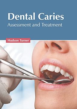 portada Dental Caries: Assessment and Treatment (en Inglés)