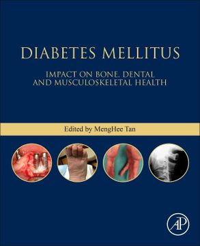 portada Diabetes Mellitus: Impact on Bone, Dental and Musculoskeletal Health (Bones, Joints, and Hormones Series) (in English)