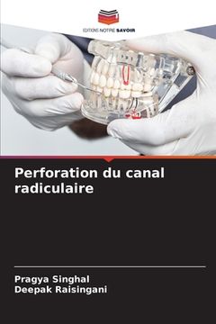 portada Perforation du canal radiculaire (en Francés)