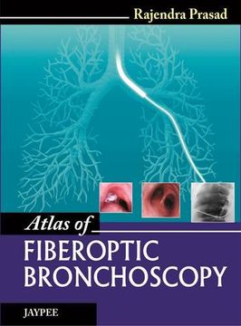 portada Atlas of Fiberoptic Bronchoscopy