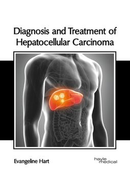 portada Diagnosis and Treatment of Hepatocellular Carcinoma (en Inglés)