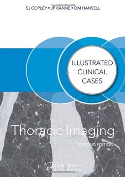 portada Thoracic Imaging: Illustrated Clinical Cases, Second Edition (en Inglés)