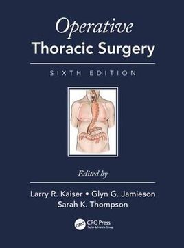 portada Operative Thoracic Surgery (en Inglés)