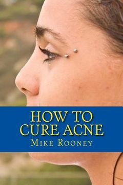 portada How To Cure Acne: What Is Acne And The Best Treatments For Acne (in English)