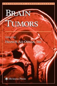 portada brain tumors (en Inglés)