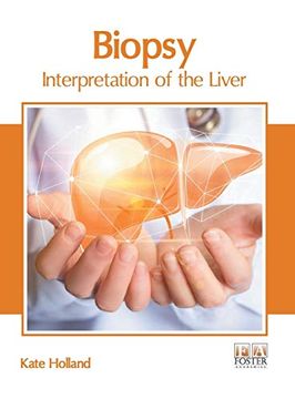 portada Biopsy: Interpretation of the Liver (en Inglés)