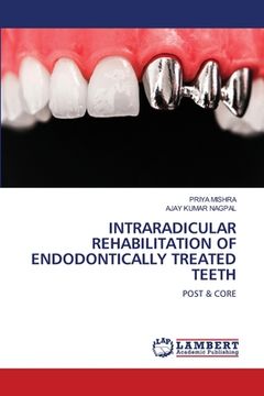 portada Intraradicular Rehabilitation of Endodontically Treated Teeth (in English)