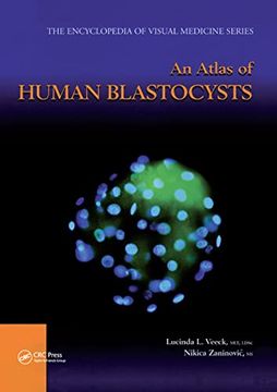 portada An Atlas of Human Blastocysts (Encyclopedia of Visual Medicine Series) (en Inglés)