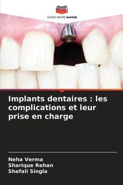 portada Implants Dentaires: Les Complications et Leur Prise en Charge (en Francés)