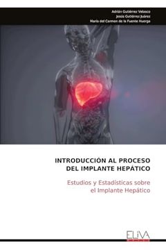 Introducción al Proceso del Implante Hepático: Estudios y Estadísticas Sobre el Implante Hepático
