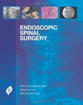 portada Endoscopic Spinal Surgery