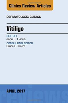 portada Vitiligo, An Issue of Dermatologic Clinics, 1e (The Clinics: Dermatology)