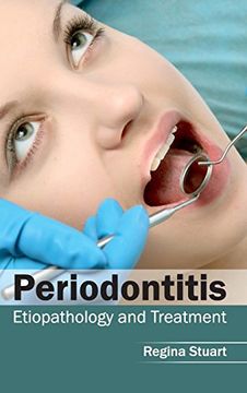 portada Periodontitis: Etiopathology and Treatment (en Inglés)